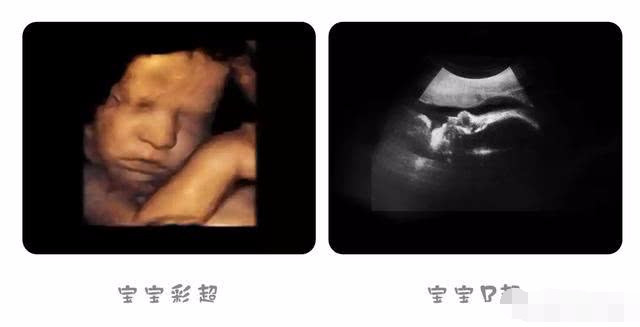 怀孕35周的胎宝宝长什么样子 孕妈要注意什么呢 看完颠覆认知