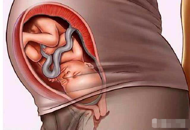 怀孕35周的胎宝宝长什么样子 孕妈要注意什么呢 看完颠覆认知