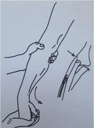 必备知识点:常见疼痛检查