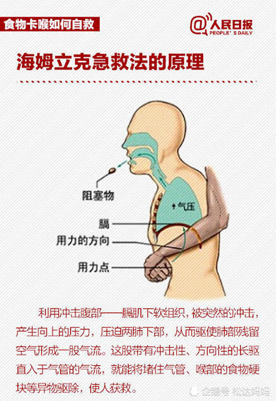 倒立!請立刻用海姆立克救命