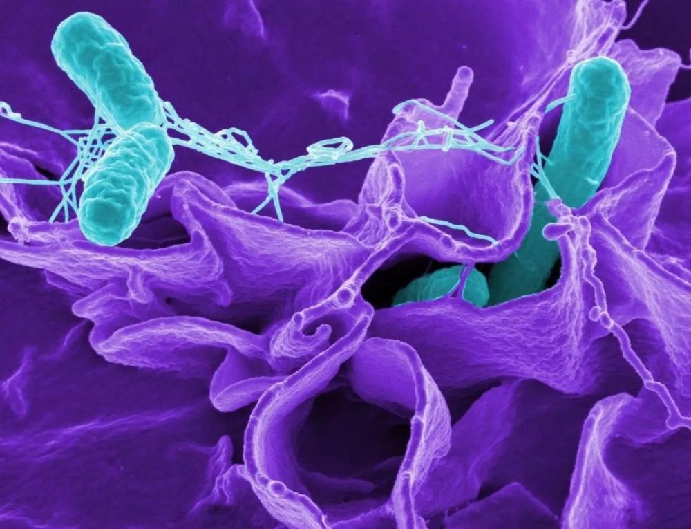 螺旋菌图片 显微镜图片