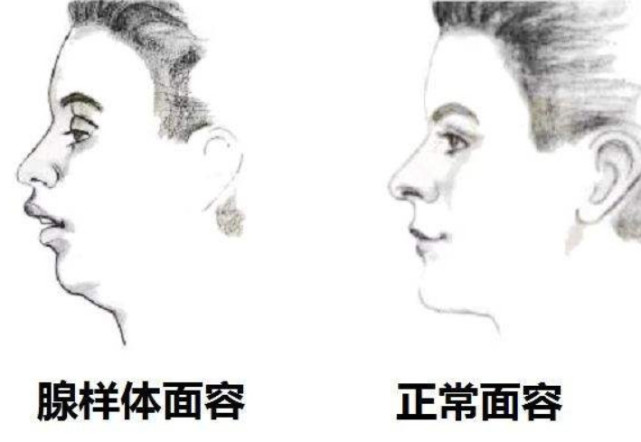 友人口罩_夏目友人帐头像口罩(3)