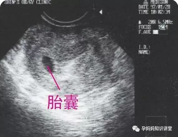 怀孕1 9个月 通过b超看胎儿慢慢长大的样子 真是太神奇了