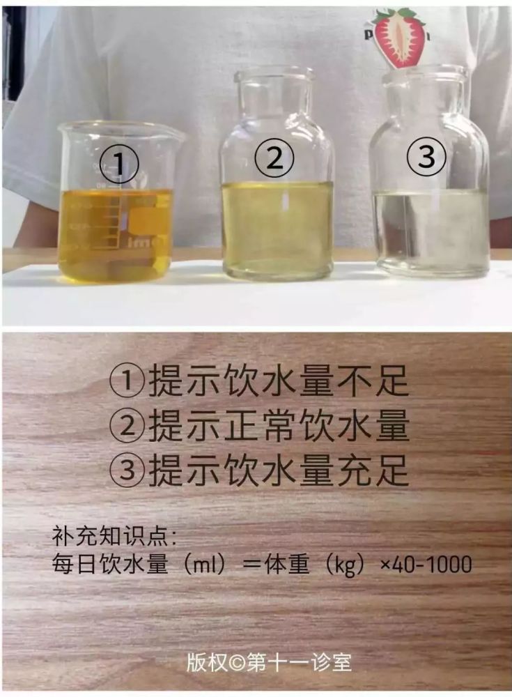 尿液颜色和健康的关系你知道多少