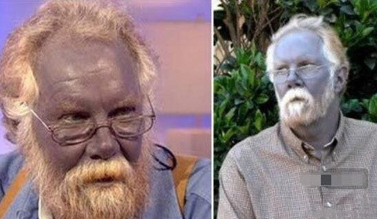 世界上的"蓝色人种",在空气稀薄的高海拔地带发现,生命力顽强