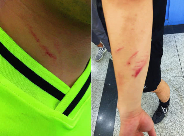 成超暴力打人者被拘留10天成都市足协追罚涉事4人终身禁赛