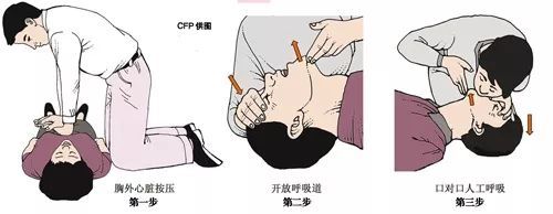 除颤仪的作用是让心脏再次恢复到正常的跳动节奏.