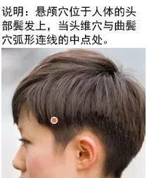 【每日一穴】悬颅穴:降浊除湿