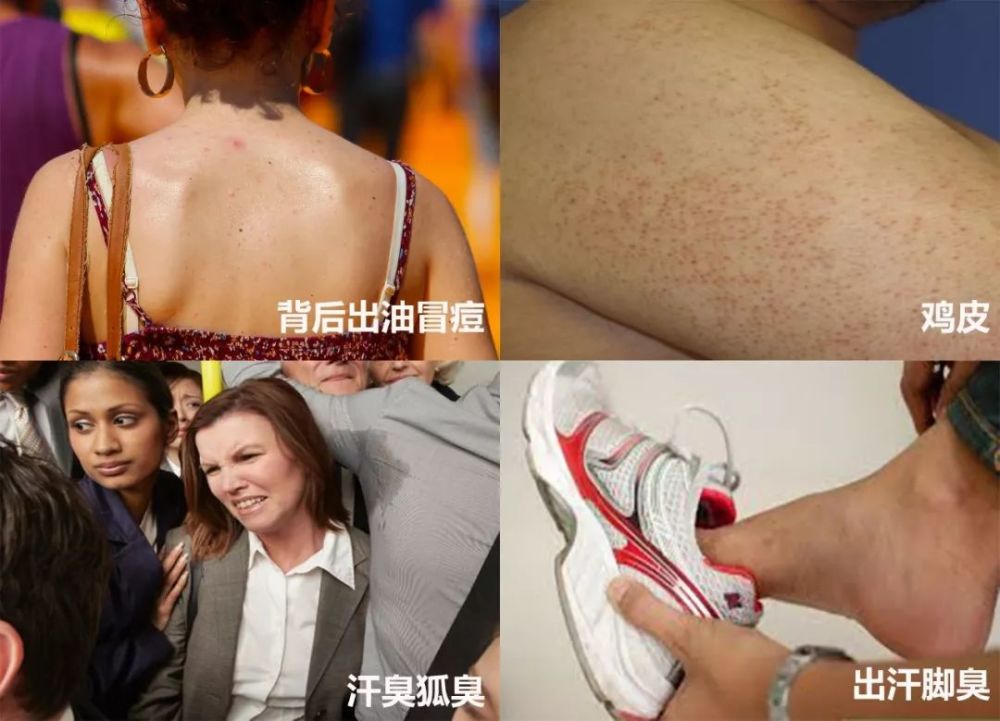 天天洗澡能改变鸡皮肤吗(天天洗澡能改变鸡皮肤吗女生)