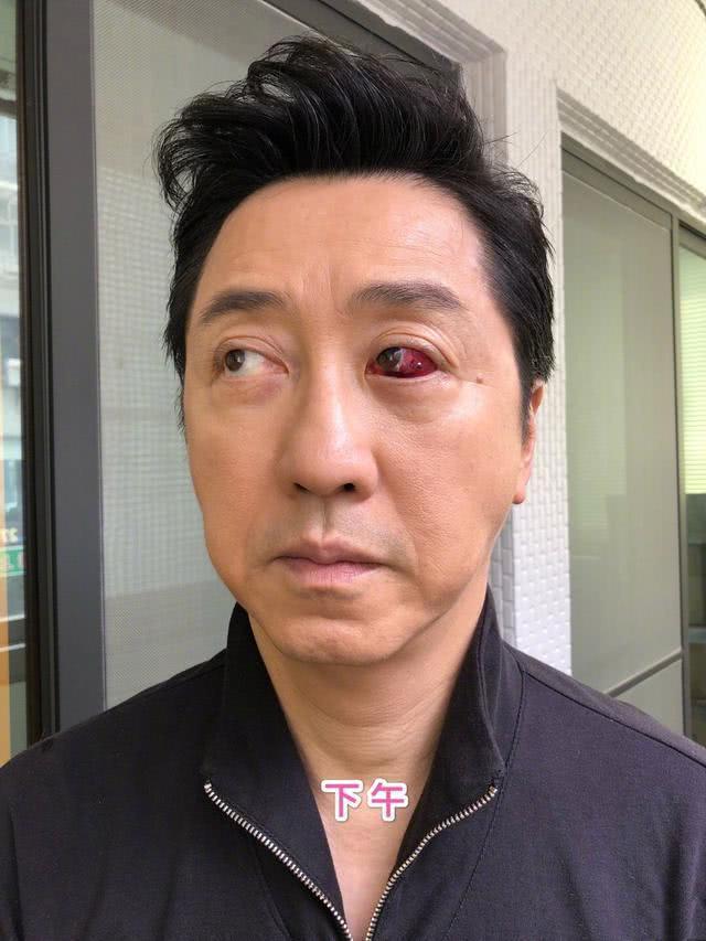 眼压高当心青光眼 医师教你这样做 远离青光眼 降眼压 青光眼预防 饮食 大纪元