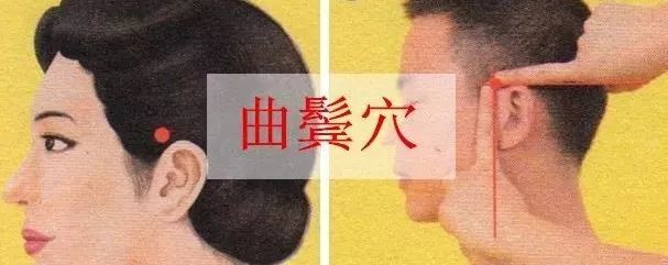 每日一穴曲鬓穴清热止痛散风消肿