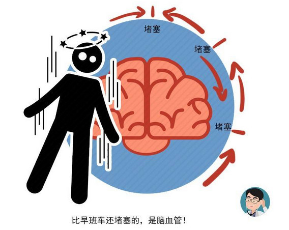 50岁后别等脑梗发作常做3个手部动作可灵活大脑预防脑梗