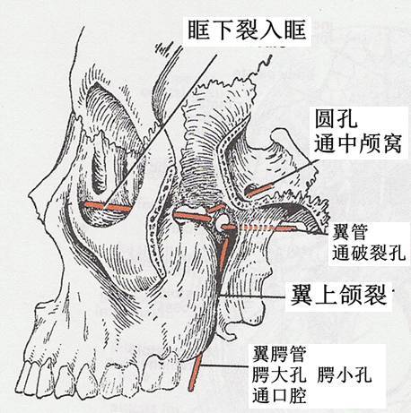 一文搞懂复杂解剖翼腭窝