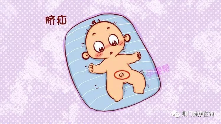 新手宝爸宝妈要注意:不是所有的新生儿异常都是病