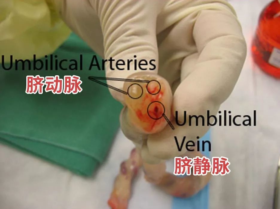 剪脐带痛的是妈妈还是宝宝