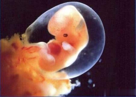 滔滔顾问 试管婴儿胎心停止发育该的原因