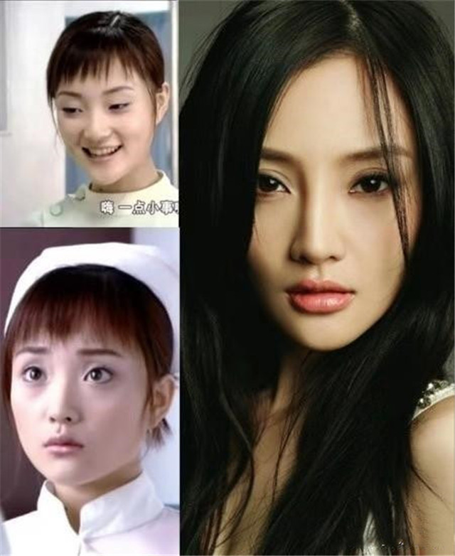 那些整容失败的女星们,大部分都无戏可拍,只有她依旧很红!