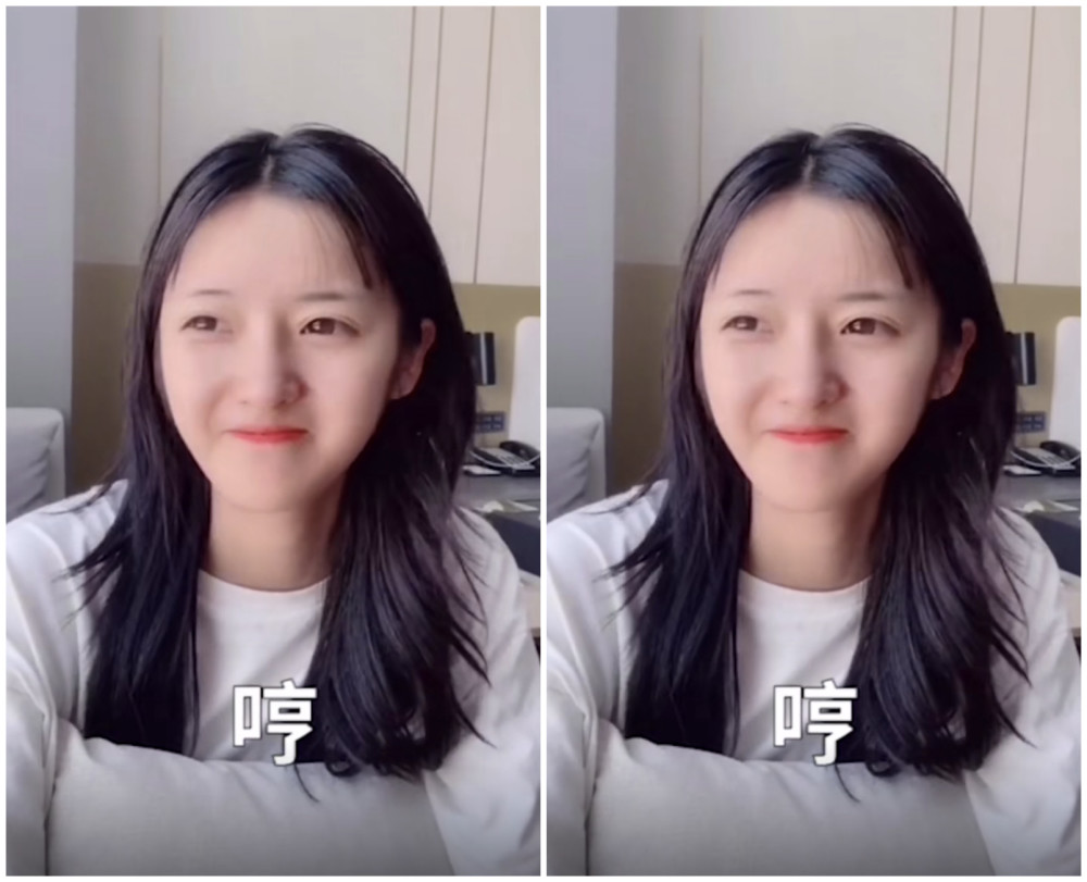 垫完鼻梁的套路璐,做表情鼻子都"僵住"了,网友:告别天然脸!