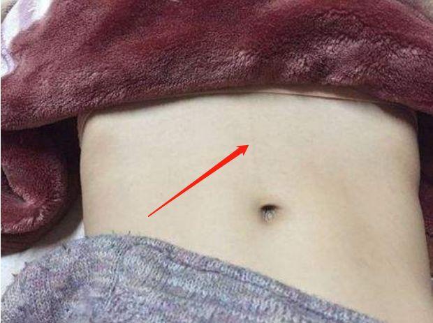 肚脐上的那根线是什么只有女孩子有吗看看医生怎么说