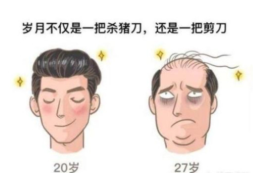 男性型脱发是什么?同样有遗传因素,为什么男女表现不同?