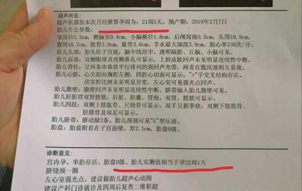 B超看胎儿的大小?准妈妈需要注意这3点