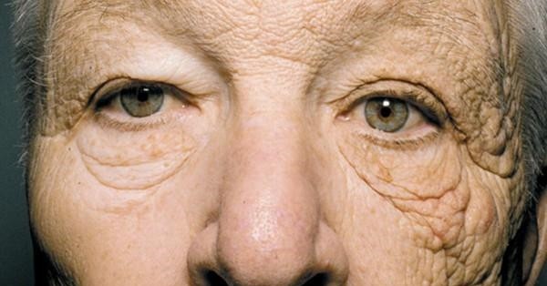 肌肤老化的关键是糖化 想保持 少女肌 就得抗糖化