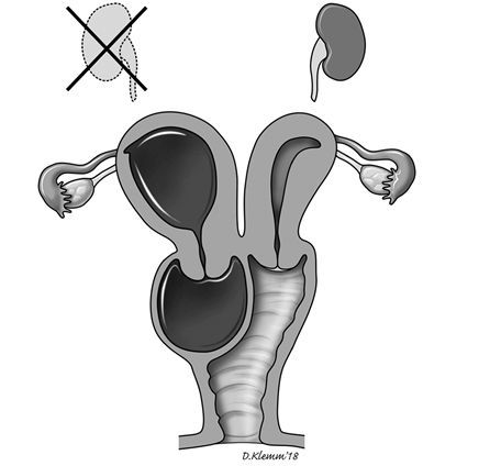 子宫形状 腾讯网