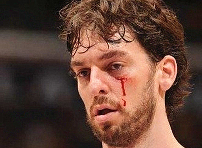 nba巨星血洒赛场瞬间,詹皇被爆头血流不止,韦德轻伤不下火线