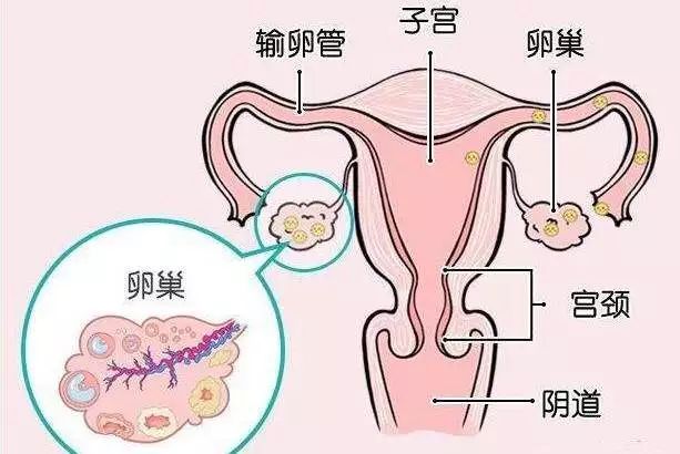 卵巢为一对实质性器官,属于女性性腺.