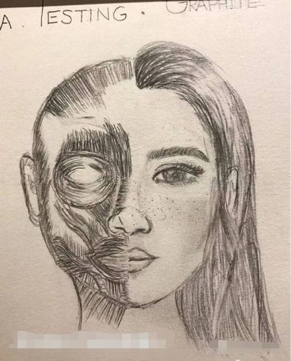 \