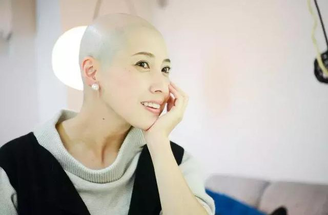 日本年轻妈妈产后头发掉光,因有辱公司员工形象,被强制辞退
