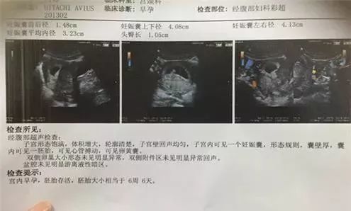 这个孕周就可以知道胎儿性别了 预测胎宝性别的5大方法