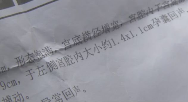 女子做完流产手术，复查发现胎儿仍在腹中…