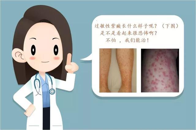 得紫癜之后有了鸡皮肤(鸡身上紫色瘀斑是怎么回事) 得紫癜之后有了鸡皮肤(鸡身上紫色瘀斑是怎么回事)