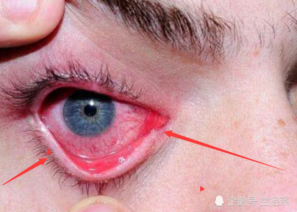 长期熬夜的人,最"怕"有这3信号,一旦出现,"猝死"近在咫尺