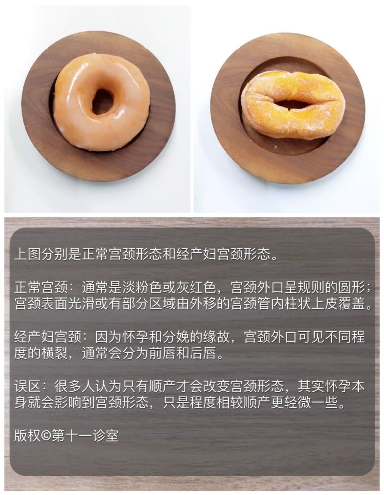 还在治疗宫颈糜烂这些宫颈问题的误区千万别踩