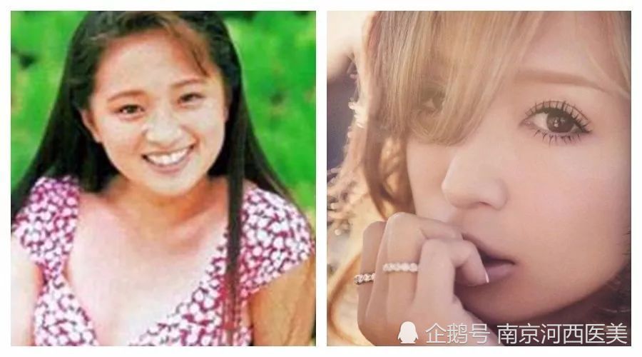 日本整容有多强 看看这些你就知道了