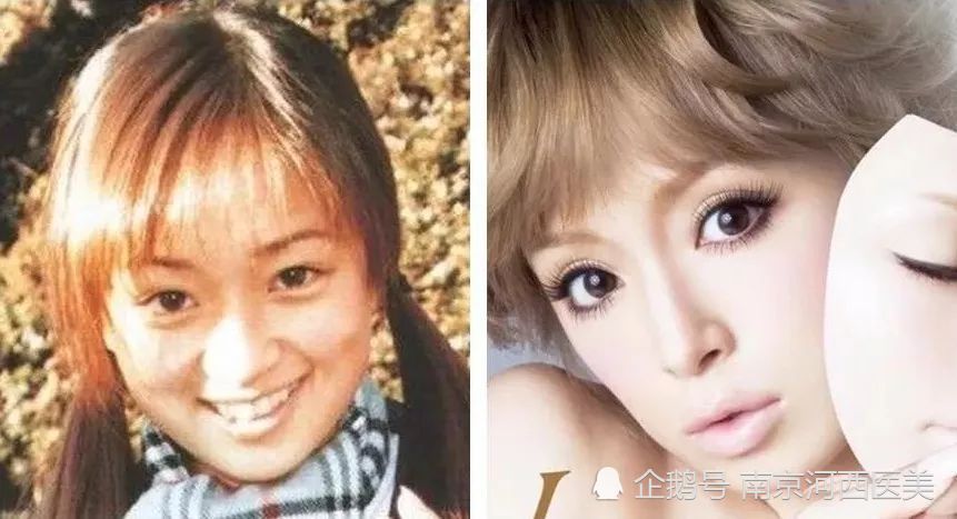 日本整容有多强 看看这些你就知道了