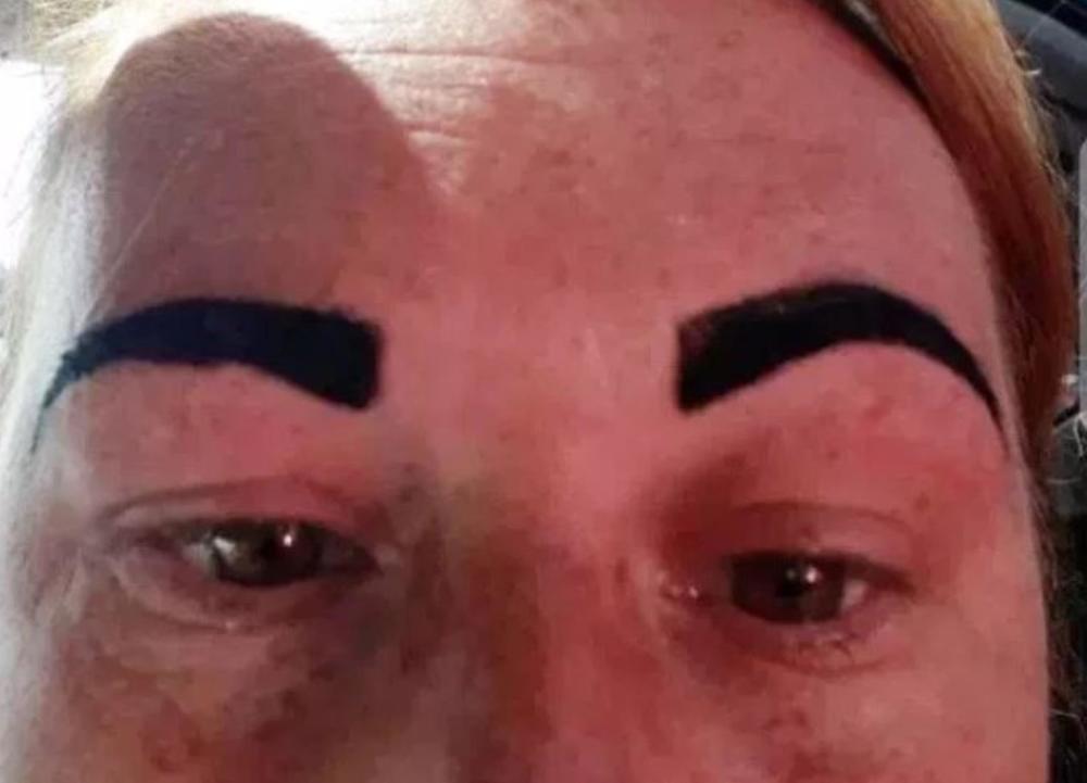 女子开心去给眉毛做美容整形 结果却变成愤怒的小鸟