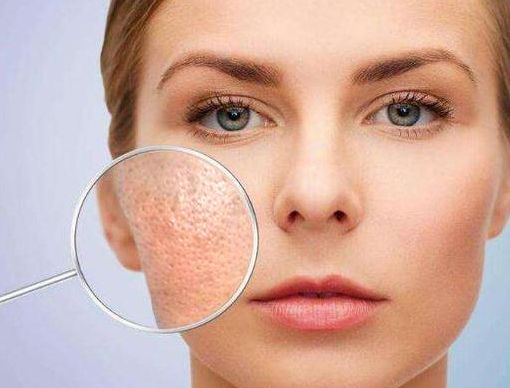 皮肤毛孔粗大很难看,女生该怎么护理和改善,皮肤专家教你怎么做
