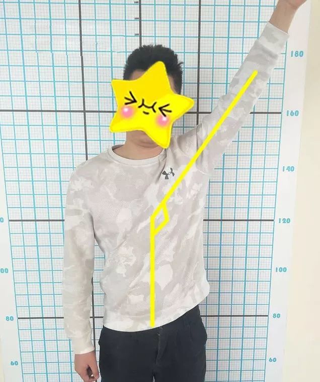 神奇 肩颈不适做这几个动作就能改善