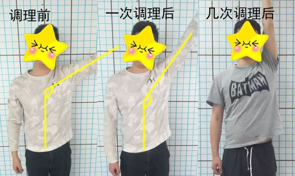 的相对中立位以及脊柱的正常曲度; 4,强化肩胛骨稳定性以及上回旋能力