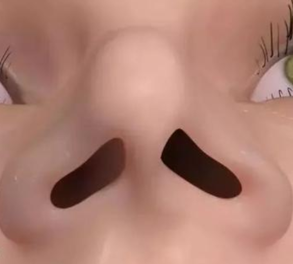 女孩子若有这3种鼻型 颜值肯定没救了 尤其第一种 不忍直视