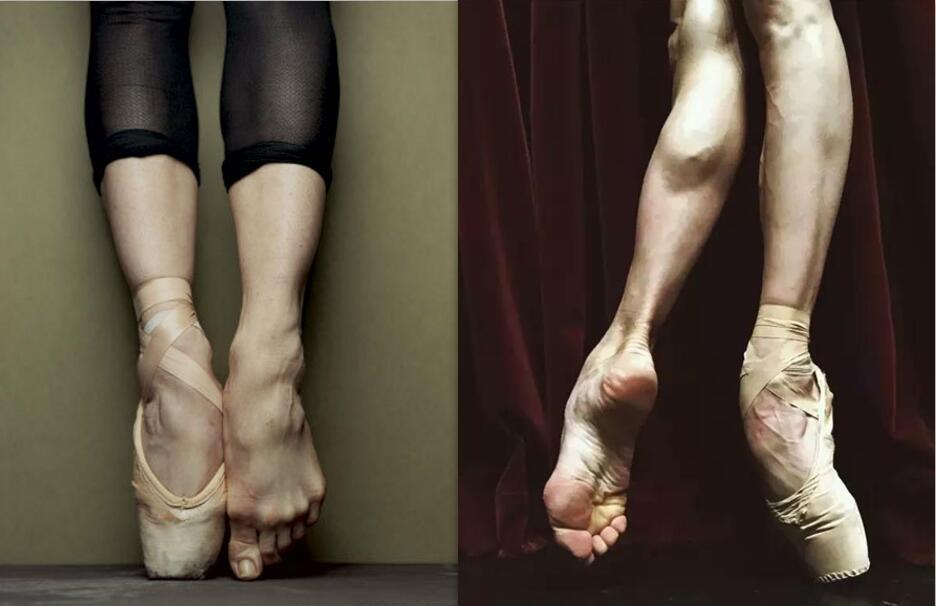 舞蹈生的脚长什么样看到伤痕累累的脚网友大家都不容易
