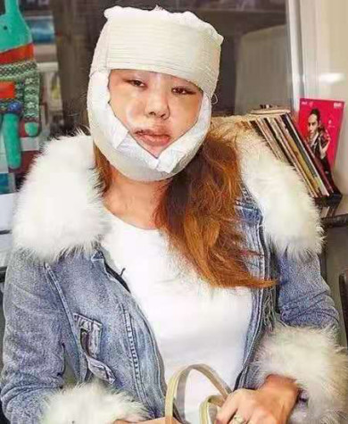 她是圈中大姐大,认8个干儿子名包当狗窝,今53穿着豪放狂整容