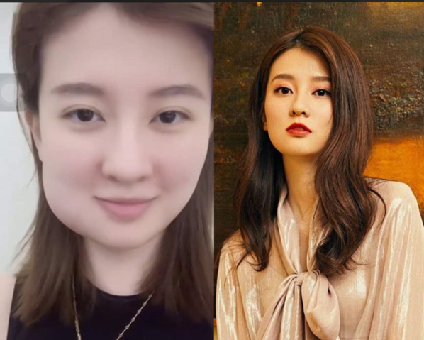 明星拔牙堪比整容,杨幂唐艺昕圆脸变瓜子脸,胡歌好像换了一个头
