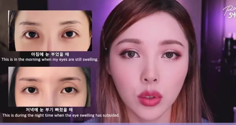 整容先整脑 整形医生是真敢说 你也真敢信 腾讯新闻