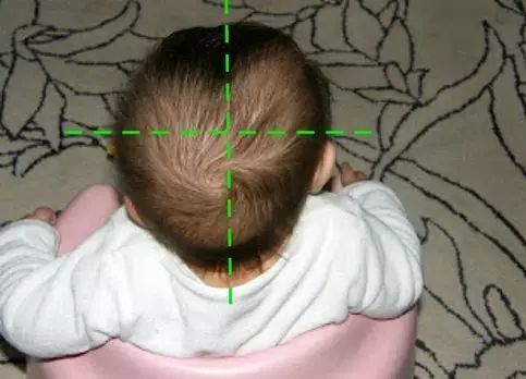 婴儿标准头型图片正面图片