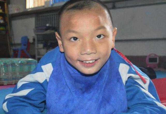 宝宝如果出现这4种症状,很可能是"脑瘫"前兆,千万不能忽视