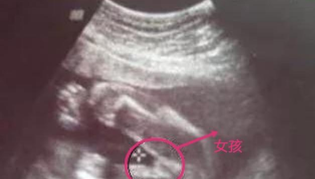 怀孕四个月宝宝b超能看出 胎儿的性别 吗